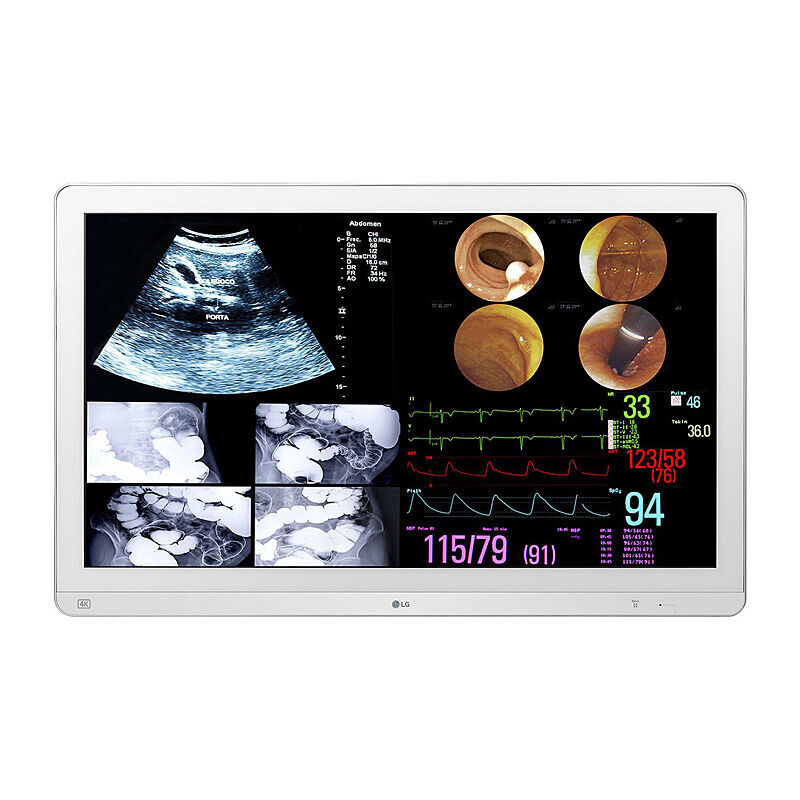 LG 31.5'' 4K Surgical